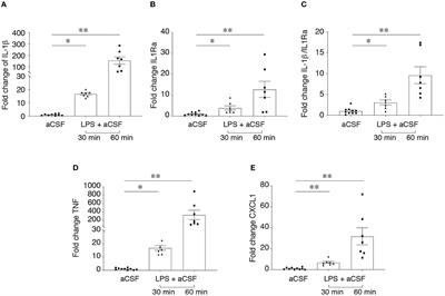 An in vitro model of drug-resistant seizures for selecting clinically effective antiseizure medications in Febrile Infection-Related Epilepsy Syndrome